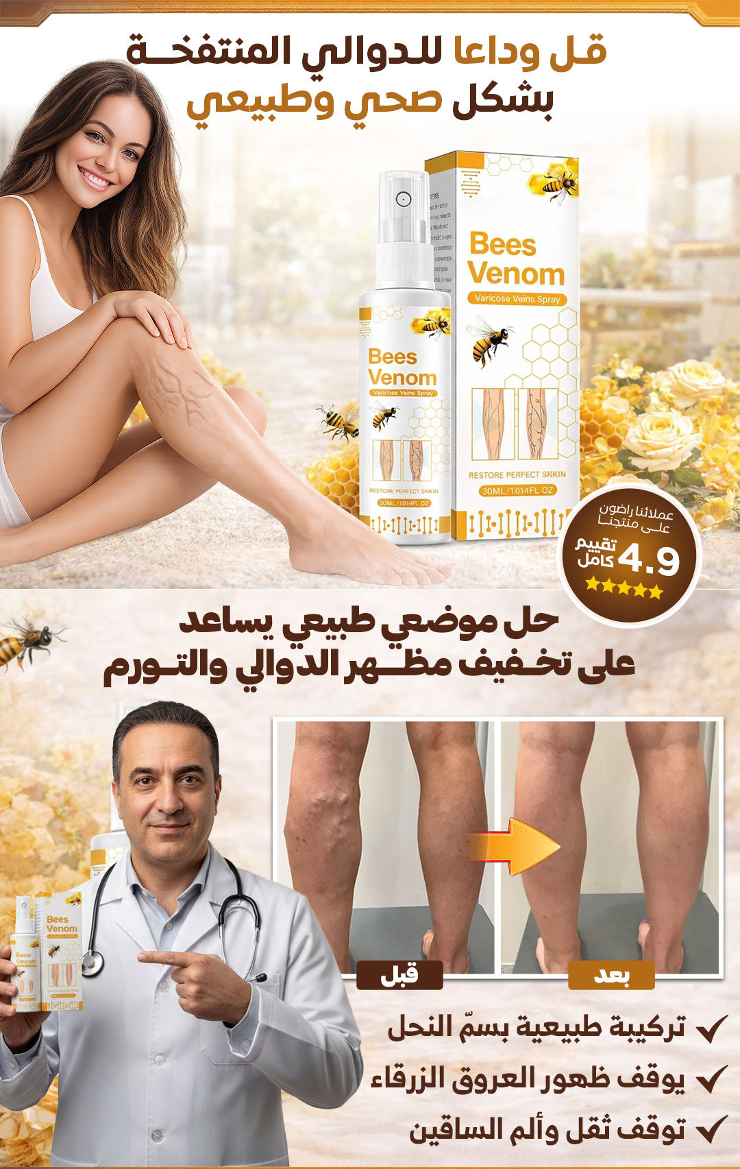 ⚡بخّاخ مدمّر دوالي الساقين 🦵🐝 💥 بقوّة سمّ النحل الطبيعي… رجّع الحيوية لساقيك من أول استعمال